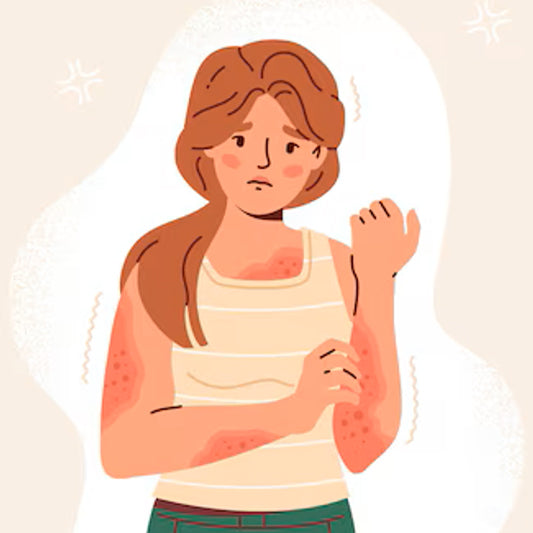 Skin Disorders